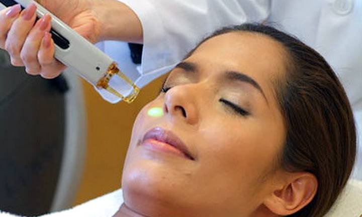 laser-vitiligo