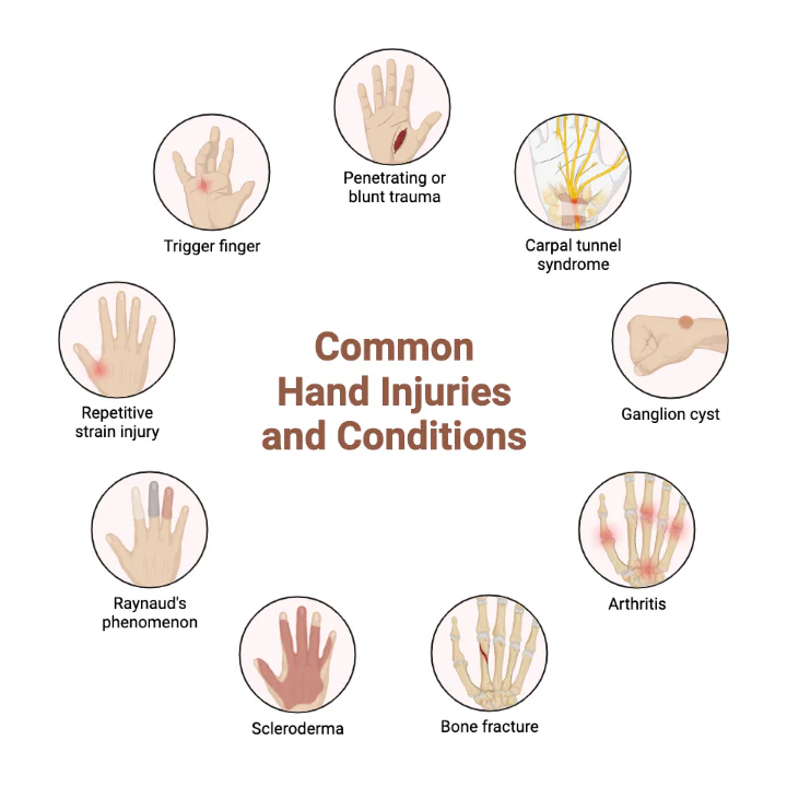 Common hand injuries and conditions treatment in Indore by Dr Animesh Damani