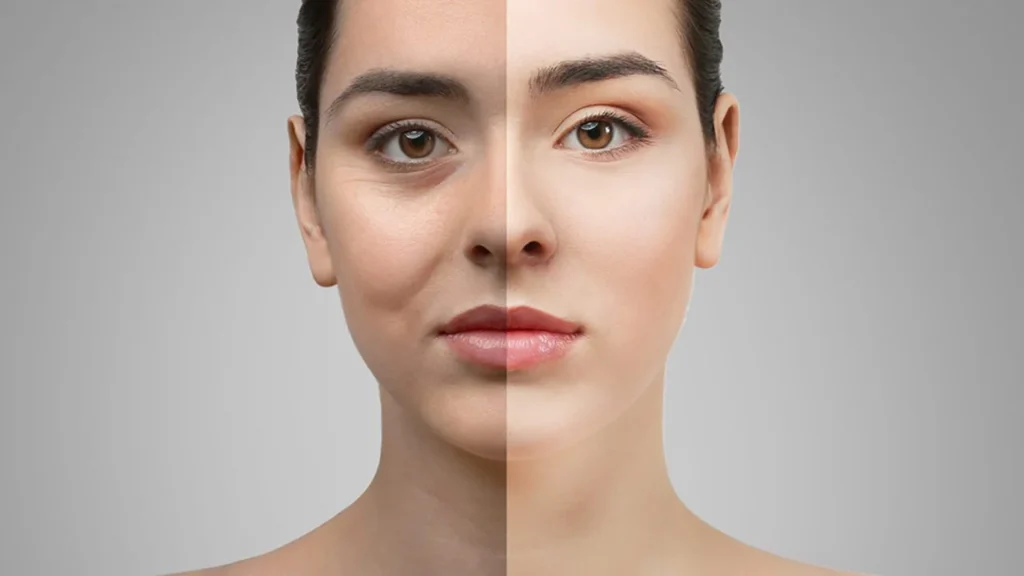 Blepharoplasty before and after results by Dr Animesh Damani Best Plastic Surgeon in Indore