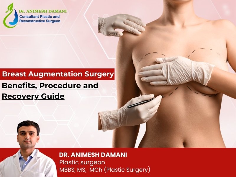 Breast Augmentation Surgery: Benefits, Procedure and Recovery Guide