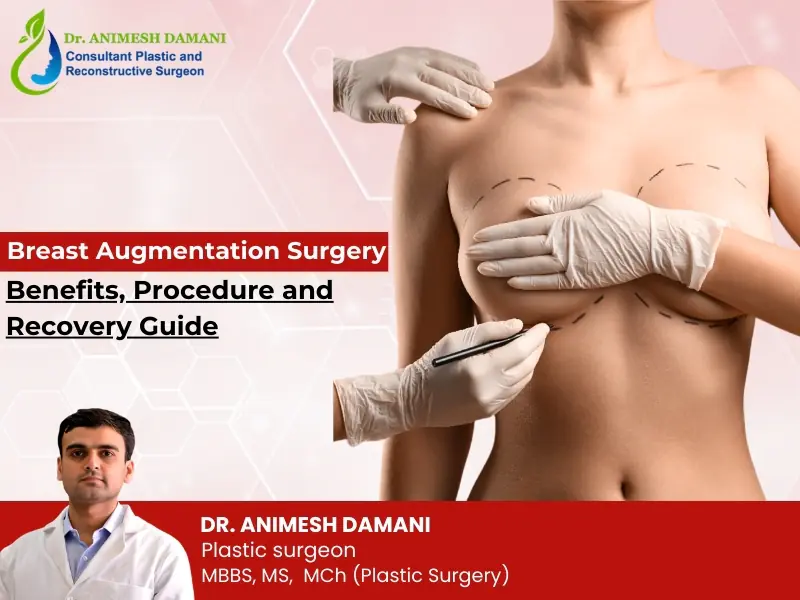 Breast augmentation surgery planning and procedure by Dr Animesh Damani Best Plastic Surgeon in Indore