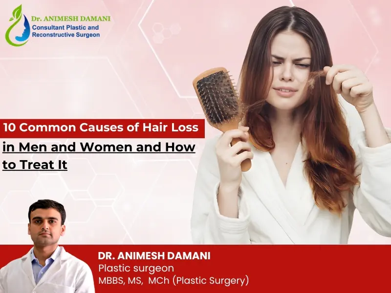 Hair loss causes and treatment options in men and women by Dr Animesh Damani Best Plastic Surgeon in Indore