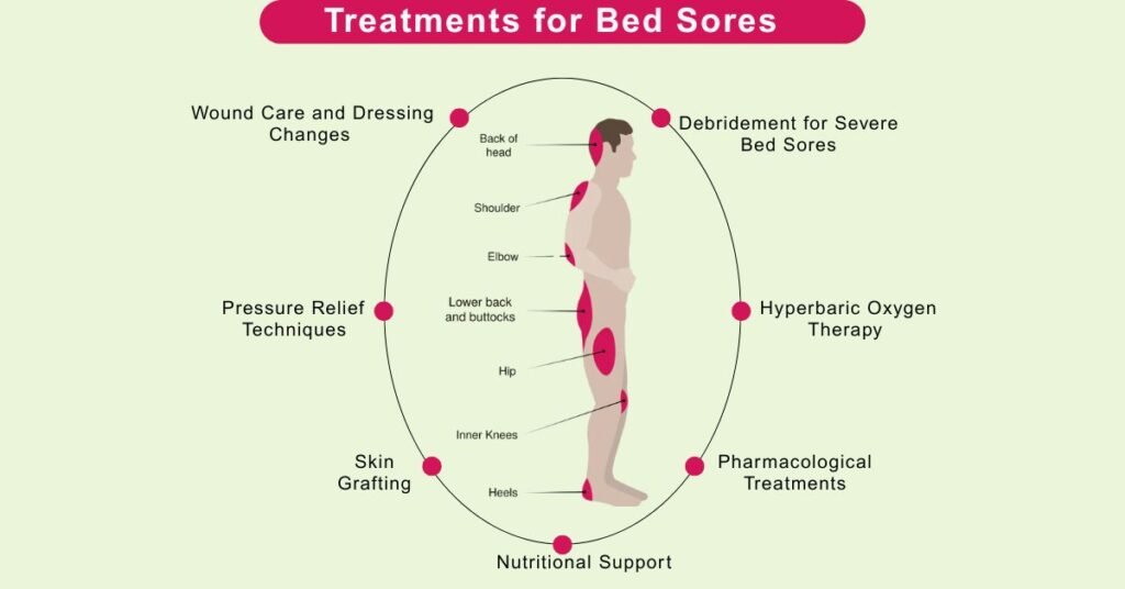Bed sores treatment methods in Indore by Dr Animesh Damani pressure ulcer care