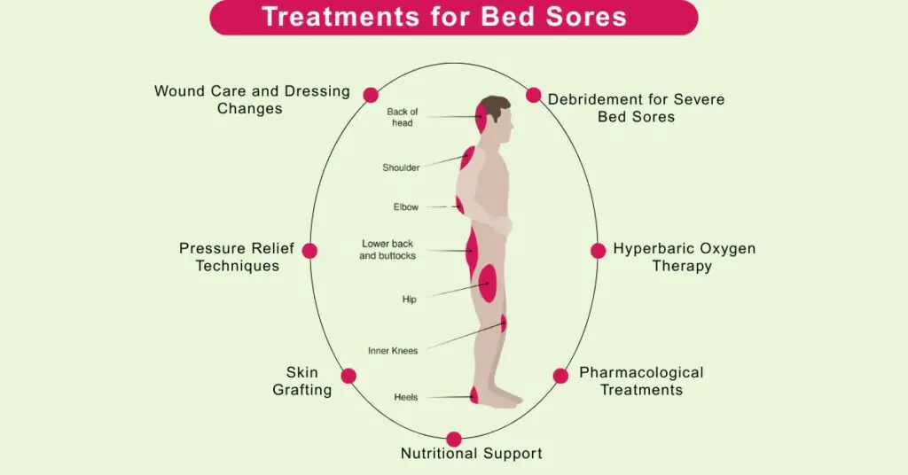 Bed sores treatment methods in Indore by Dr Animesh Damani pressure ulcer care