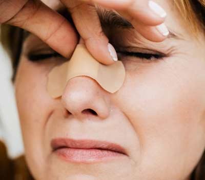 Facial fracture treatment in Indore by Dr Animesh Damani nose injury care