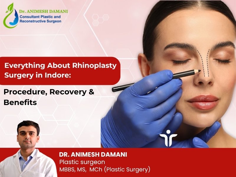 Everything About Rhinoplasty Surgery in Indore: Procedure, Recovery & Benefits