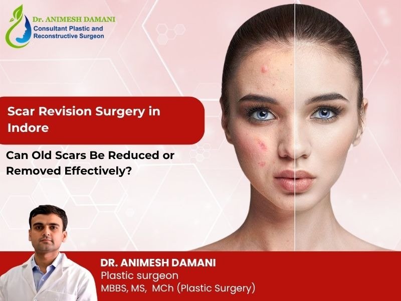 Scar Revision Surgery in Indore: Can Old Scars Be Reduced or Removed Effectively?
