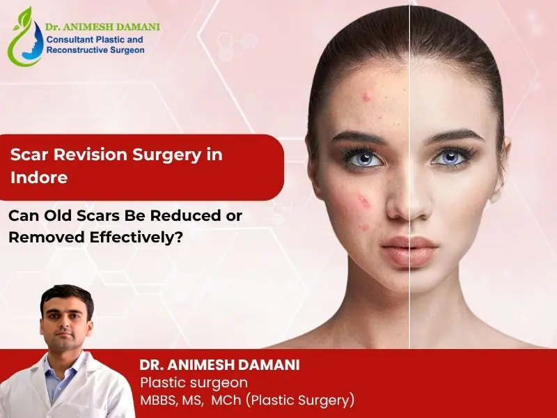 Scar Revision Surgery in Indore: Can Old Scars Be Reduced or Removed Effectively?