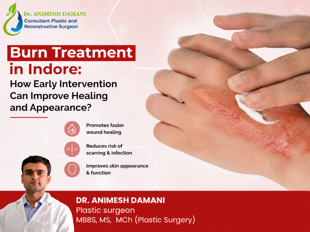 Burn Treatment in Indore: How Early Intervention Can Improve Healing and Appearance?
